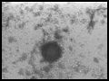 In Vitro Fertilization(IVF)