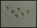 In Vitro Fertilization(IVF)
