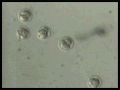 In Vitro Fertilization(IVF)