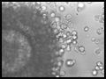 In Vitro Fertilization(IVF)