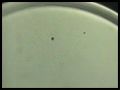 In Vitro Fertilization(IVF)