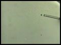 In Vitro Fertilization(IVF)