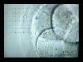 Laser Hatching