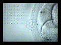 Laser Hatching