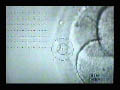 Laser Hatching