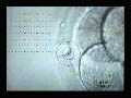 Laser Hatching