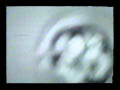 Laser Hatching