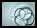 Laser Hatching