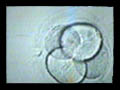 Laser Hatching