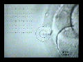 Laser Hatching