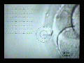 Laser Hatching